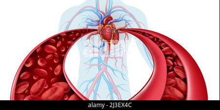Hypertonie und hoher Blutdruck als medizinisches Diagrammkonzept mit einem normalen und abnormalen hypertensiven Blutkörperchenfluss und menschlicher Durchblutung. Stockfoto