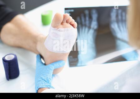 Der Traumatologe führt eine MRT-Untersuchung der Füße des männlichen Beins durch Stockfoto