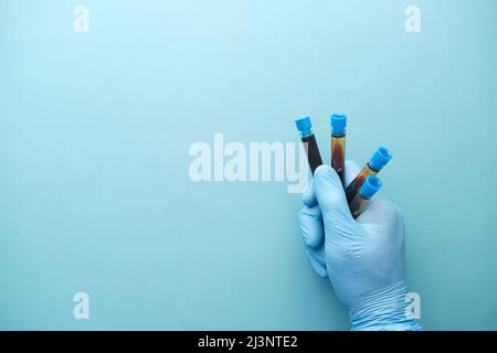 Hand in blauen medizinischen Handschuhen, die den Blutschlauch halten Stockfoto