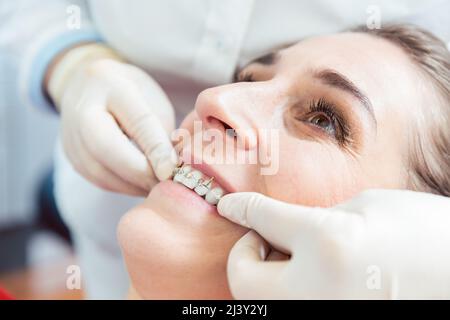 Der Zahnarzt legt Zahnspangen auf die Zähne der weiblichen Patientin Stockfoto