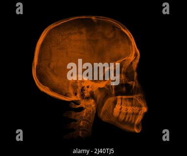 Menschlicher Schädel. Orangefarbenes Röntgenbild isoliert auf schwarzem Hintergrund Stockfoto