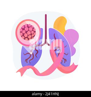 Lungenkrebs abstrakte Konzept Vektor-Illustration. Onkologie Frühstadiologie, Tumor Risikofaktor, Lungenkrebsbehandlung, Bekämpfung von Krankheiten, chemische Stock Vektor