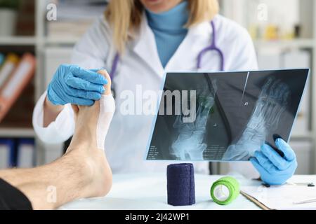 Patient mit Beinverletzung bei der Nahaufnahme des Arztes Stockfoto