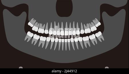 Menschliches Röntgenbild der Zähne, Vektordarstellung Stock Vektor