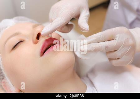 Die Kosmetikerin hält nach der Injektion von Hyaluronsäure einen Tropfen Öl auf ihre Finger vor den Lippen des Mädchens Stockfoto