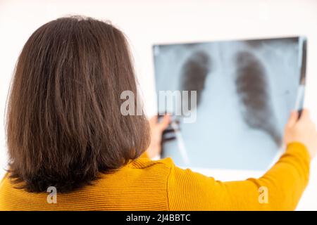 Junger langhaariger Mann hält Röntgen und sieht es an, isoliert Medium Nahaufnahme weißen Hintergrund . Hochwertige Fotos Stockfoto