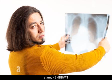 Junge attraktive Mann hält Röntgen, traurigen Blick auf die Kamera isoliert Medium Nahaufnahme weißen Hintergrund . Hochwertige Fotos Stockfoto