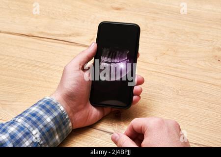 Der Mann hält das Smartphone mit einem XRAY aus seinem Zahn. Hervorhebung von Schmerzflecken. Zahnarzt und medizinische Analyse Stockfoto