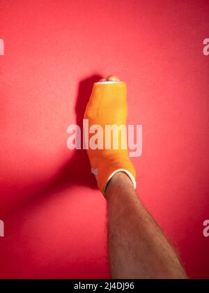 Fuß mit gebrochenem Zehenbein in orangefarbenem Fiberglas auf rosa Hintergrund. Verletzte gebrochene geschwollene männliche Bein in modernen orthopädischen wasserdichten Guss aus s Stockfoto