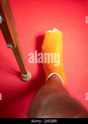 Fuß mit gebrochenem Zehenbein in orangefarbenem Fiberglas auf rosa Hintergrund. Verletzte gebrochene geschwollene männliche Bein in modernen orthopädischen wasserdichten Guss aus s Stockfoto