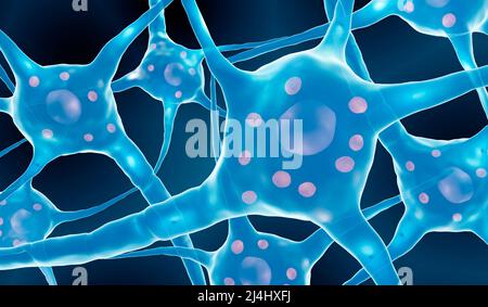 Nervenzellen der Parkinson-Krankheit, Illustration Stockfoto