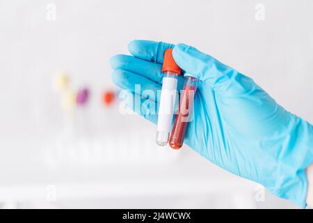 Hand hält zwei leere Reagenzgläser vor dem Hintergrund der Fläschchen Stockfoto