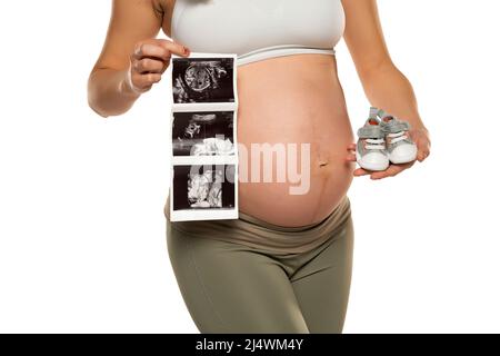 Schwangere mit Ultraschallbildern und einem Paar grauer Baby-Sneakers auf weißem Hintergrund. Stockfoto