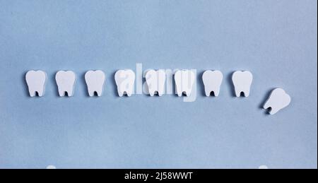 Zahnverlust. Zahnreihe mit fehlendem, gefallener auf blauem Hintergrund. Schlechte Mundhygiene und Zahnpflege, Parodontalerkrankungen, Verletzungen. Hochwertige Fotos Stockfoto