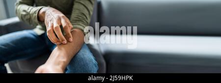 Mittelteil der Mann sitzt auf einem Sofa Juckreiz Leiden. Stockfoto