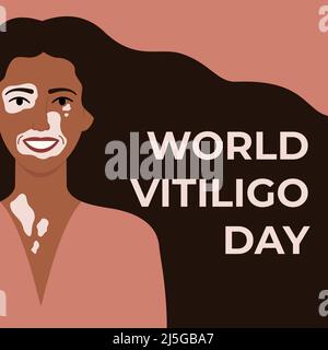 Welt Vitiligo Tag 25. Juni quadratisches Banner. Gesicht der afrikanischen Frau mit Vitiligo Hautkrankheit. Body-positive-Konzept. Flache Vektorgrafik Stock Vektor