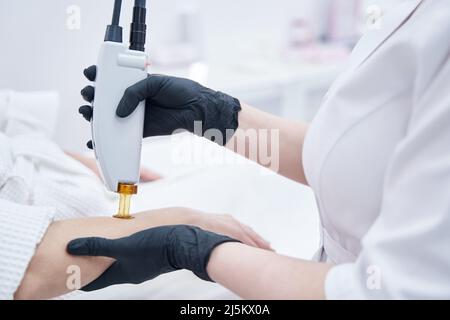 Kosmetikerin Hände Durchführung Laser-Haarentfernung Verfahren Stockfoto