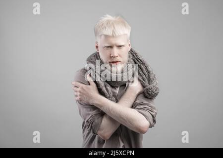 Kranker Albino-Mann mit Schal um den Hals, der sich kalt fühlte, während er über grauem Studiohintergrund stand Stockfoto