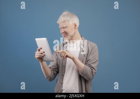Positiver Albino-Mann in Freizeitkleidung mit digitalem Tablet, online arbeiten oder studieren, E-Mail senden, blauer Hintergrund Stockfoto