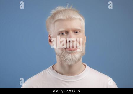 Konzept der Hautabnormität. Porträt eines bärtigen, hübschen Albino-Mannes, der vor der Kamera über dem blauen Studiohintergrund posiert Stockfoto