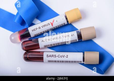 Verdacht auf Adenovirus als Schuldige bei der Hepatitis im Kindesalter unbekannter Herkunft. Hepatisch, sars-cov2. Stockfoto