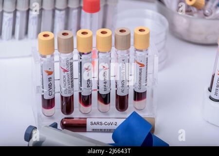 Verdacht auf Adenovirus als Schuldige bei der Hepatitis im Kindesalter unbekannter Herkunft. Hepatisch, sars-cov2. Stockfoto