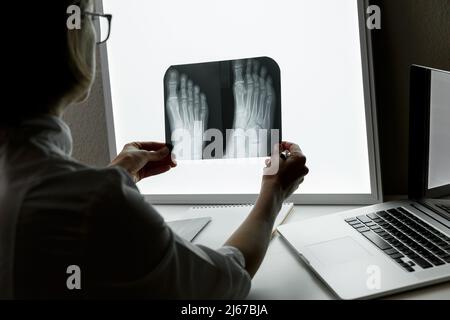 Orthopädischer Chirurg, der eine Röntgenaufnahme des Fußes untersucht. Konzept der Gesundheitsversorgung und Krankenversicherung Stockfoto