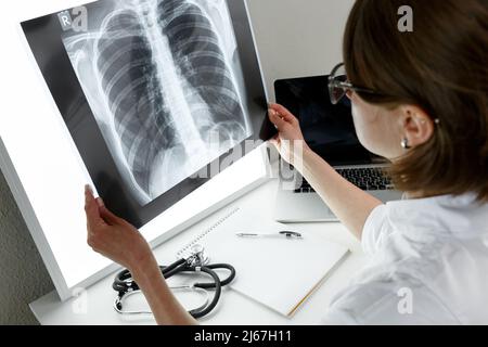 Pulmonologischer Therapeut, der eine Röntgenaufnahme der Lunge untersucht. Konzept der Gesundheitsversorgung und Krankenversicherung Stockfoto