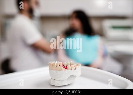 Zahnform mit Zahnwerkzeugen, die die Zähne des Ober- und Unterkiefers zeigt Stockfoto