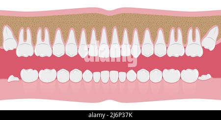Gesunde weiße menschliche Zähne in einer Reihe. Schöne, gleichmäßige Zähne mit Wurzeln. Das Zahnfleisch wird bis in den Knochen geschnitten. Struktur des Kiefers.Infographische Elemente für Delle Stock Vektor