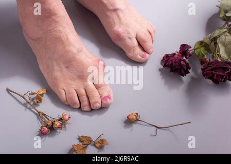 Fußkrankheit Konzept der trockenen Blumen zu Füßen der alten Frau auf grauem Hintergrund Stockfoto