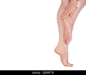 Konzept für die Beinpflege und Hautbehandlung. Trockene und rissige Fußsohlen auf weißem Hintergrund. Schmerzende Haut der Füße, Risse, trockene Fersen. Trockene und rissige Sohlen von Stockfoto