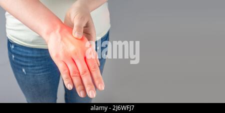 Karpaltunnelsyndrom, Arthritis, neurologisches Krankheitskonzept. Taubheit der Hand. Frau, die unter Schmerzen in der Hand leidet. Nahaufnahme einer Frau mit Schmerzen Stockfoto