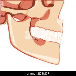 Schädel Skelett Mensch teilweise Ansicht der Kopfseite. Modell der menschlichen Kiefer mit Zahnreihe. Set von Chump realistische flache natürliche Farbe Konzept Vektor-Illustration der Anatomie isoliert auf weißem Hintergrund Stock Vektor