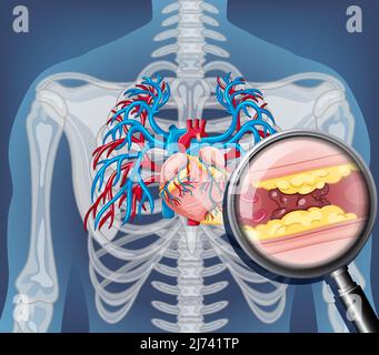 Darstellung der Röntgenaufnahme des menschlichen Körpers mit inneren Organen Stock Vektor