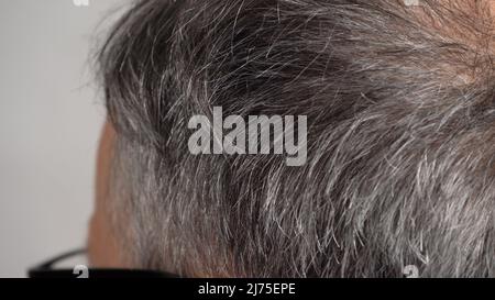 Graues Haar auf dem Kopf eines Mannes Stockfoto