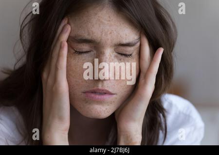 Frustriert erschöpfte Sommersprossen Mädchen berühren schmerzhaften Kopf mit geschlossenen Augen Stockfoto