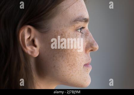 Nachdenkliche Sommersprossen Teenager-Mädchen Gesichtsbehandlung aus nächster Nähe Stockfoto