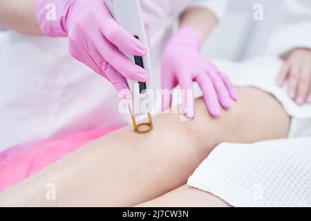 Weibliche Kosmetikerin mit Alexandrit Haarentfernungslaser in der Klinik Stockfoto