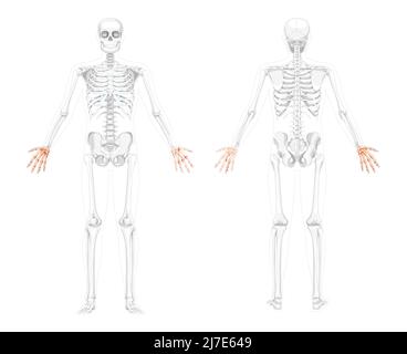 Skeletthände menschliche Vorderansicht mit zwei Armhaltungen mit teilweise transparenter Knochenposition. Handgelenk 3D realistisches flaches Konzept Vektor-Illustration der Anatomie isoliert auf weißem Hintergrund Stock Vektor