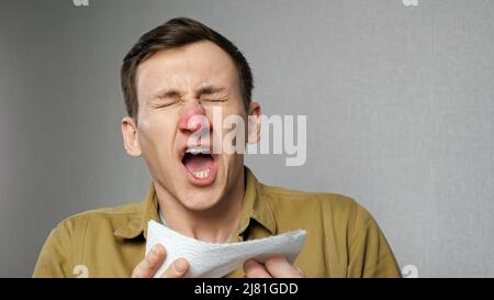 Mann mit roter Nase niest, leidet an einer Stauballergie Stockfoto