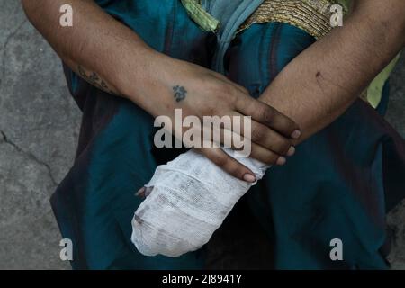 Neu-Delhi, Indien. 14.. Mai 2022. Ein Opfer des Brandunfalls, der in ein Geschäftsgebäude einbrach, gibt ein Interview. (Bild: © Karma Sonam Bhutia/ZUMA Press Wire) Bild: ZUMA Press, Inc./Alamy Live News Stockfoto