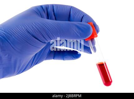 Reagenzglas (Vacutainer) mit Blut in der Hand in Handschuhen. Virenanalyse. Stockfoto