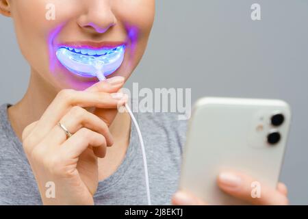 Eine Frau hält in der Hand eine ultraviolette Lampe für die Zahnaufhellung zu Hause. Ein schneeweißes Lächeln nach dem Bleichen. Stockfoto