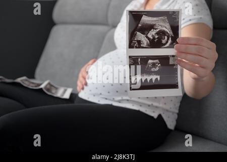 Eine Schwangere demonstriert ihr Ultraschallfoto, während sie zu Hause auf dem Sofa sitzt. Das Bild mit Ultraschalluntersuchung liegt im Vordergrund und hat einen Fokus. Stockfoto