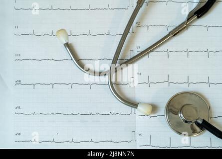 Nahaufnahme des Stethoskops und ekg-Testergebnispapiers. Konzept der Herzgesundheit und Herz-Kreislauf-Untersuchung. Stockfoto