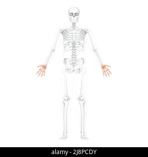 Skeletthände menschliche Vorderansicht mit zwei Armhaltungen mit teilweise transparenter Knochenposition. Karpale, Handgelenk, Metacarpale, Pals. 3D realistisches flaches Konzept Vektordarstellung der Anatomie isoliert Stock Vektor