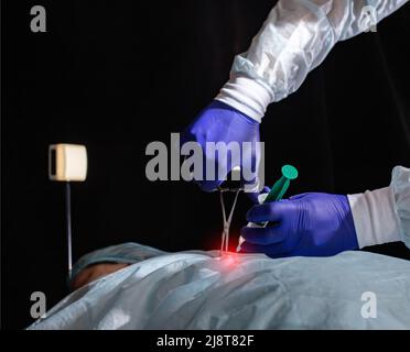 Operation, um die Bauchspeicheldrüse zu entfernen und eine Biopsie der Leber des Patienten, Nahaufnahme. Laparoskopisch Stockfoto