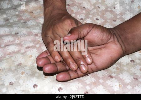 Ein Bein Baby zur Pflege zur Hand Stockfoto