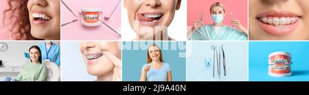 Set von Frauen mit Zahnspangen, Zahnbusch und Zahnarzt mit Werkzeugen Stockfoto